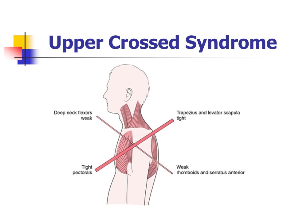 Avoid upper cross syndrome and maintain rotator cuff stability